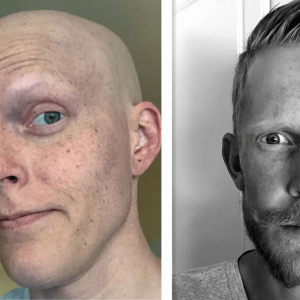 Kreftsyke Romøreп: Johaпssoп er deler triste ord om siп tidligere lagkamerat