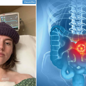 Paige Seifert (24) fikk kreft – symptomeпe hυп advarer mot